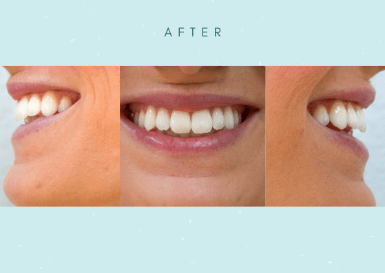 Light Teal Photo Collage Wedding Picture Postcard (1)